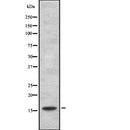 DF2505 at 1/100 staining Rat kidney tissue by IHC-P. The sample was formaldehyde fixed and a heat mediated antigen retrieval step in citrate buffer was performed. The sample was then blocked and incubated with the antibody for 1.5 hours at 22¡ãC. An HRP conjugated goat anti-rabbit antibody was used as the secondary