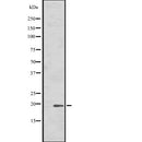 Western blot analysis of HSPB7 expression in  Human fetal heart cell lysate ,The lane on the left is treated with the antigen-specific peptide.