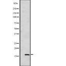 DF2507 at 1/100 staining Mouse testis tissue by IHC-P. The sample was formaldehyde fixed and a heat mediated antigen retrieval step in citrate buffer was performed. The sample was then blocked and incubated with the antibody for 1.5 hours at 22¡ãC. An HRP conjugated goat anti-rabbit antibody was used as the secondary