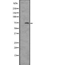 DF2508 at 1/100 staining Human urothelial cancer tissue by IHC-P. The sample was formaldehyde fixed and a heat mediated antigen retrieval step in citrate buffer was performed. The sample was then blocked and incubated with the antibody for 1.5 hours at 22¡ãC. An HRP conjugated goat anti-rabbit antibody was used as the secondary