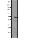 Western blot analysis of IL17RB expression in HEK293 cells ,The lane on the left is treated with the antigen-specific peptide.