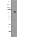 Western blot analysis of IL17RD expression in  IMR32 whole cell lysate ,The lane on the left is treated with the antigen-specific peptide.