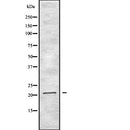 DF2514 at 1/100 staining Human uterus tissue by IHC-P. The sample was formaldehyde fixed and a heat mediated antigen retrieval step in citrate buffer was performed. The sample was then blocked and incubated with the antibody for 1.5 hours at 22¡ãC. An HRP conjugated goat anti-rabbit antibody was used as the secondary