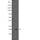 Western blot analysis of IGF2 expression in  Hela cell lysate,The lane on the left is treated with the antigen-specific peptide.