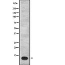 DF2517 at 1/100 staining Human Melanoma tissue by IHC-P. The sample was formaldehyde fixed and a heat mediated antigen retrieval step in citrate buffer was performed. The sample was then blocked and incubated with the antibody for 1.5 hours at 22¡ãC. An HRP conjugated goat anti-rabbit antibody was used as the secondary
