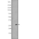 Western blot analysis of IL11 expression in  Human Plasma Total Protein Lysate ,The lane on the left is treated with the antigen-specific peptide.