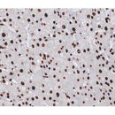 AF0142 at 1/200 staining human Liver tissue sections by IHC-P. The tissue was formaldehyde fixed and a heat mediated antigen retrieval step in citrate buffer was performed. The tissue was then blocked and incubated with the antibody for 1.5 hours at 22¡ãC. An HRP conjugated goat anti-rabbit antibody was used as the secondary