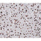 AF0142 at 1/200 staining human Liver tissue sections by IHC-P. The tissue was formaldehyde fixed and a heat mediated antigen retrieval step in citrate buffer was performed. The tissue was then blocked and incubated with the antibody for 1.5 hours at 22¡ãC. An HRP conjugated goat anti-rabbit antibody was used as the secondary