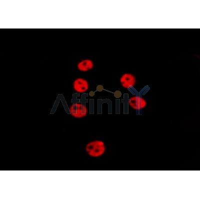 AF0142 staining HepG2 by IF/ICC. The sample were fixed with PFA and permeabilized in 0.1% Triton X-100,then blocked in 10% serum for 45 minutes at 25¡ãC. The primary antibody was diluted at 1/200 and incubated with the sample for 1 hour at 37¡ãC. An  Alexa Fluor 594 conjugated goat anti-rabbit IgG (H+L) Ab, diluted at 1/600, was used as the secondary antibod