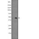 DF2519 at 1/100 staining Human uterus tissue by IHC-P. The sample was formaldehyde fixed and a heat mediated antigen retrieval step in citrate buffer was performed. The sample was then blocked and incubated with the antibody for 1.5 hours at 22¡ãC. An HRP conjugated goat anti-rabbit antibody was used as the secondary