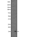 DF2520 at 1/100 staining Human uterus tissue by IHC-P. The sample was formaldehyde fixed and a heat mediated antigen retrieval step in citrate buffer was performed. The sample was then blocked and incubated with the antibody for 1.5 hours at 22¡ãC. An HRP conjugated goat anti-rabbit antibody was used as the secondary