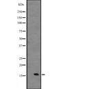 DF2521 at 1/100 staining Mouse lung tissue by IHC-P. The sample was formaldehyde fixed and a heat mediated antigen retrieval step in citrate buffer was performed. The sample was then blocked and incubated with the antibody for 1.5 hours at 22¡ãC. An HRP conjugated goat anti-rabbit antibody was used as the secondary