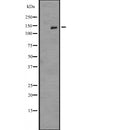 DF2522 at 1/100 staining Mouse liver tissue by IHC-P. The sample was formaldehyde fixed and a heat mediated antigen retrieval step in citrate buffer was performed. The sample was then blocked and incubated with the antibody for 1.5 hours at 22¡ãC. An HRP conjugated goat anti-rabbit antibody was used as the secondary