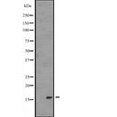 Western blot analysis of IL1F5 expression in  Transfected 293T cell lysate ,The lane on the left is treated with the antigen-specific peptide.
