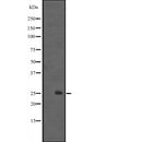 DF2524 at 1/100 staining Human Melanoma tissue by IHC-P. The sample was formaldehyde fixed and a heat mediated antigen retrieval step in citrate buffer was performed. The sample was then blocked and incubated with the antibody for 1.5 hours at 22¡ãC. An HRP conjugated goat anti-rabbit antibody was used as the secondary