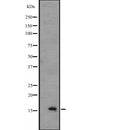 DF2525 at 1/100 staining Mouse colon tissue by IHC-P. The sample was formaldehyde fixed and a heat mediated antigen retrieval step in citrate buffer was performed. The sample was then blocked and incubated with the antibody for 1.5 hours at 22¡ãC. An HRP conjugated goat anti-rabbit antibody was used as the secondary