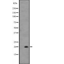DF2528 at 1/100 staining Mouse testis tissue by IHC-P. The sample was formaldehyde fixed and a heat mediated antigen retrieval step in citrate buffer was performed. The sample was then blocked and incubated with the antibody for 1.5 hours at 22¡ãC. An HRP conjugated goat anti-rabbit antibody was used as the secondary