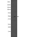 Western blot analysis of IL5RA expression in  Mouse heart tissue lysates ;,The lane on the left is treated with the antigen-specific peptide.
