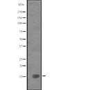 DF2532 at 1/100 staining Human pancreas tissue by IHC-P. The sample was formaldehyde fixed and a heat mediated antigen retrieval step in citrate buffer was performed. The sample was then blocked and incubated with the antibody for 1.5 hours at 22¡ãC. An HRP conjugated goat anti-rabbit antibody was used as the secondary