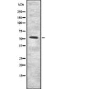 DF2535 at 1/100 staining Human lymph node tissue by IHC-P. The sample was formaldehyde fixed and a heat mediated antigen retrieval step in citrate buffer was performed. The sample was then blocked and incubated with the antibody for 1.5 hours at 22¡ãC. An HRP conjugated goat anti-rabbit antibody was used as the secondary
