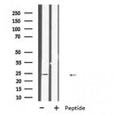 DF2536 at 1/100 staining Mouse testis tissue by IHC-P. The sample was formaldehyde fixed and a heat mediated antigen retrieval step in citrate buffer was performed. The sample was then blocked and incubated with the antibody for 1.5 hours at 22¡ãC. An HRP conjugated goat anti-rabbit antibody was used as the secondary