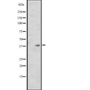 Western blot analysis of ISL1 expression in  HL60 whole cell lysate ,The lane on the left is treated with the antigen-specific peptide.