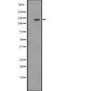 Western blot analysis of ITGA1 expression in  Hela cell lysate,The lane on the left is treated with the antigen-specific peptide.