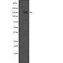 DF2542 at 1/100 staining Human Head and neck cancer tissue by IHC-P. The sample was formaldehyde fixed and a heat mediated antigen retrieval step in citrate buffer was performed. The sample was then blocked and incubated with the antibody for 1.5 hours at 22¡ãC. An HRP conjugated goat anti-rabbit antibody was used as the secondary