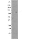 Western blot analysis of ITGB6 expression in  ITGB6 transfected 293T cell lysate,The lane on the left is treated with the antigen-specific peptide.