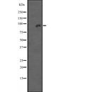Immunohistochemical analysis of paraffin-embedded Human colon tissue labeling Integrin beta 7 