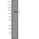 Western blot analysis of ITGB8 expression in  Placenta lysate ,The lane on the left is treated with the antigen-specific peptide.