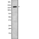 Western blot analysis of JAD1B expression in HEK293 cells ,The lane on the left is treated with the antigen-specific peptide.