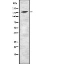 DF2548 at 1/100 staining Human kidney tissue by IHC-P. The sample was formaldehyde fixed and a heat mediated antigen retrieval step in citrate buffer was performed. The sample was then blocked and incubated with the antibody for 1.5 hours at 22¡ãC. An HRP conjugated goat anti-rabbit antibody was used as the secondary