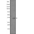 Western blot analysis of JAM1 expression in  Hela cell lysate,The lane on the left is treated with the antigen-specific peptide.