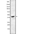 DF2551 at 1/100 staining Human liver cancer tissue by IHC-P. The sample was formaldehyde fixed and a heat mediated antigen retrieval step in citrate buffer was performed. The sample was then blocked and incubated with the antibody for 1.5 hours at 22¡ãC. An HRP conjugated goat anti-rabbit antibody was used as the secondary