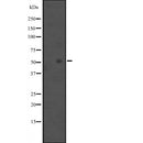 DF2552 staining HepG2 by IF/ICC. The sample were fixed with PFA and permeabilized in 0.1% Triton X-100,then blocked in 10% serum for 45 minutes at 25¡ãC. The primary antibody was diluted at 1/200 and incubated with the sample for 1 hour at 37¡ãC. An  Alexa Fluor 594 conjugated goat anti-rabbit IgG (H+L) Ab, diluted at 1/600, was used as the secondary antibod