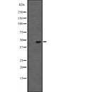 Western blot analysis of extracts from various samples, using KRT31/33A/33B Antibody.
 Lane 1: 293 treated with blocking peptide;
 Lane 2: 293;
 Lane 3: Hybridoma cells.