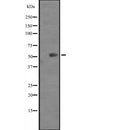 Western blot analysis of KRT82 expression in  Mouse heart tissue lysates ,The lane on the left is treated with the antigen-specific peptide.