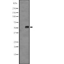 Western blot analysis of KRT85/86 expression in  OVCAR 3 cell lysate ;,The lane on the left is treated with the antigen-specific peptide.