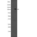 Western blot analysis of MCF2 expression in  K562 cell line lysate ;,The lane on the left is treated with the antigen-specific peptide.