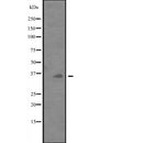 Western blot analysis of PDCD1LG2 expression in  ZR-75-1 cell lysate ,The lane on the left is treated with the antigen-specific peptide.