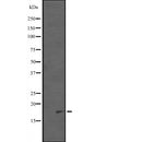 Western blot analysis of PDCD5 expression in  EL4 cell lysate ;,The lane on the left is treated with the antigen-specific peptide.