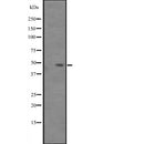 DF2563 at 1/100 staining Mouse muscle tissue by IHC-P. The sample was formaldehyde fixed and a heat mediated antigen retrieval step in citrate buffer was performed. The sample was then blocked and incubated with the antibody for 1.5 hours at 22¡ãC. An HRP conjugated goat anti-rabbit antibody was used as the secondary