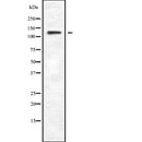 Western blot analysis of PLCB4 expression in HEK293 cells ,The lane on the left is treated with the antigen-specific peptide.