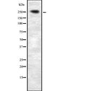 DF2565 at 1/100 staining Mouse lung tissue by IHC-P. The sample was formaldehyde fixed and a heat mediated antigen retrieval step in citrate buffer was performed. The sample was then blocked and incubated with the antibody for 1.5 hours at 22¡ãC. An HRP conjugated goat anti-rabbit antibody was used as the secondary