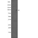 Western blot analysis of ANAPC4 expression in  Hela cell lysate,The lane on the left is treated with the antigen-specific peptide.
