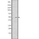 DF2572 at 1/100 staining Human liver cancer tissue by IHC-P. The sample was formaldehyde fixed and a heat mediated antigen retrieval step in citrate buffer was performed. The sample was then blocked and incubated with the antibody for 1.5 hours at 22¡ãC. An HRP conjugated goat anti-rabbit antibody was used as the secondary