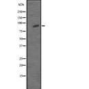 DF2573 at 1/100 staining Mouse spleen tissue by IHC-P. The sample was formaldehyde fixed and a heat mediated antigen retrieval step in citrate buffer was performed. The sample was then blocked and incubated with the antibody for 1.5 hours at 22¡ãC. An HRP conjugated goat anti-rabbit antibody was used as the secondary