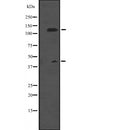 DF2574 at 1/100 staining Human liver tissue by IHC-P. The sample was formaldehyde fixed and a heat mediated antigen retrieval step in citrate buffer was performed. The sample was then blocked and incubated with the antibody for 1.5 hours at 22¡ãC. An HRP conjugated goat anti-rabbit antibody was used as the secondary