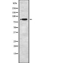 Western blot analysis of STRN1/3 expression in HEK293 cells ,The lane on the left is treated with the antigen-specific peptide.